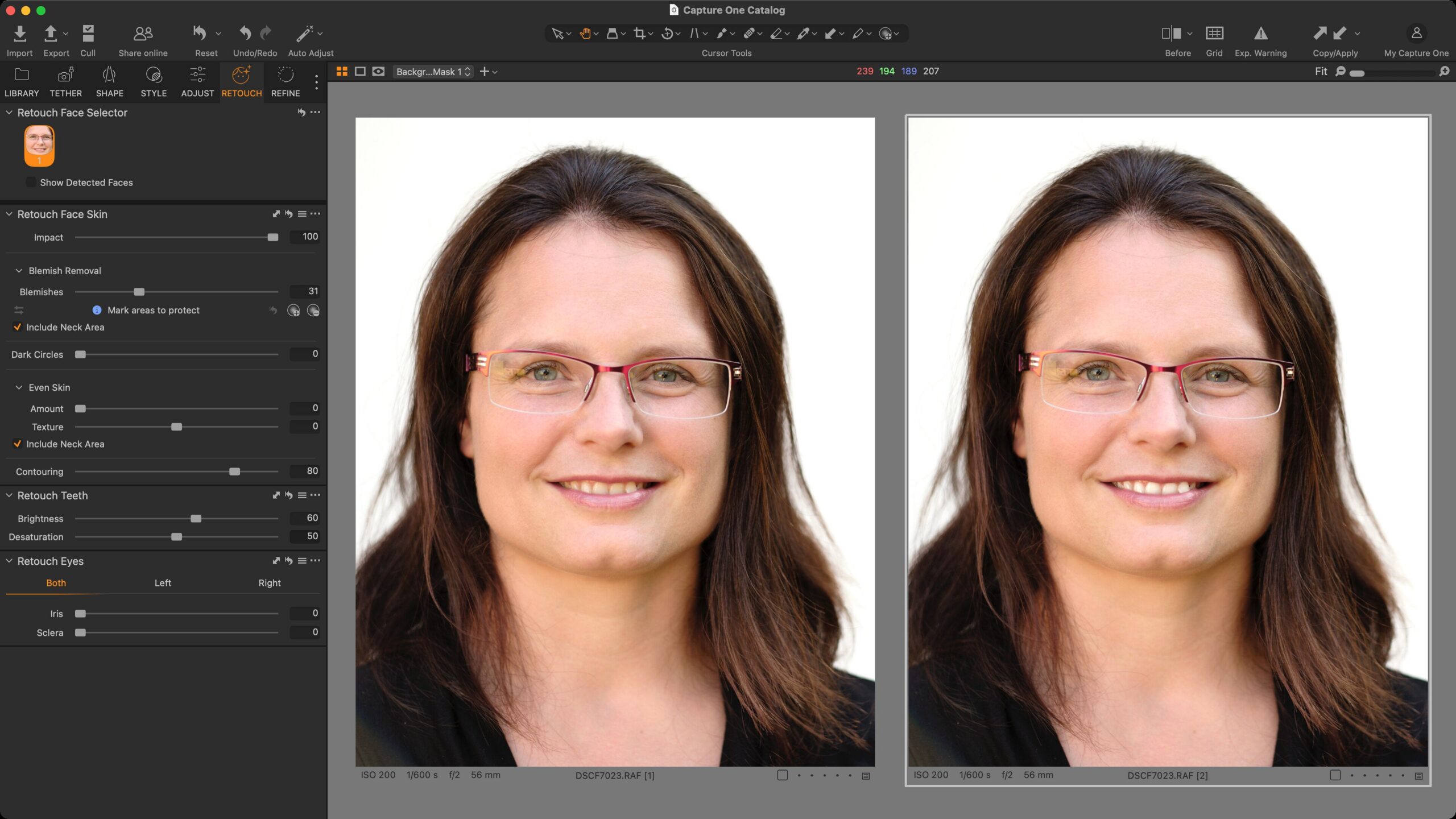 Ukázka zesvětlení a desaturace zubů nástrojem Retouch Teeth.