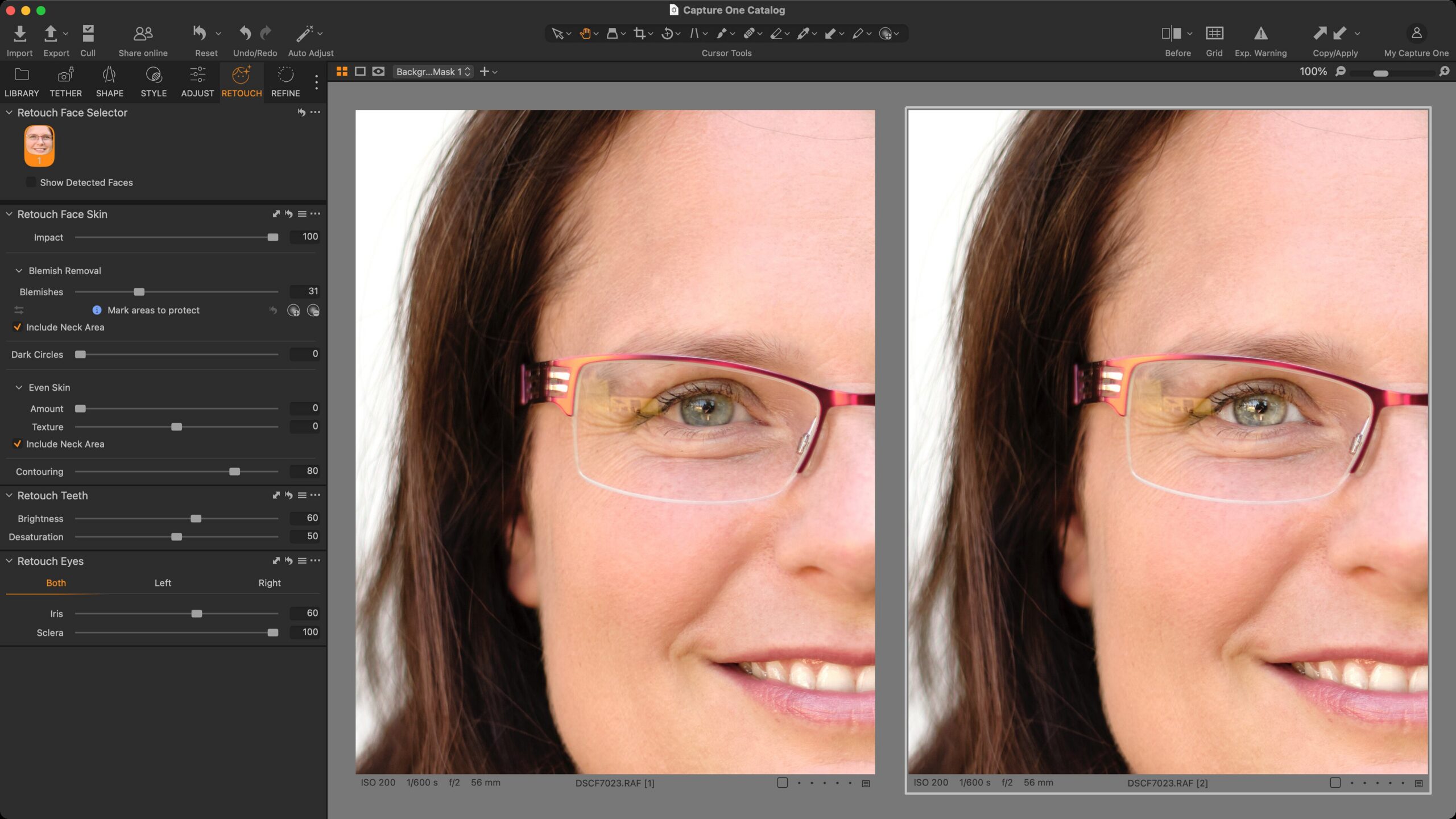 Ukázka úpravy duhovky – trochu intenzivnější, než je žádoucí, aby byl efekt na obrázku dobře patrný – i bělma.